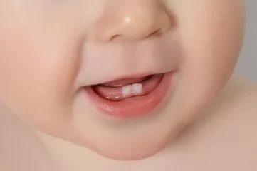 超声羞羞视频在线看免费厂家宝宝长牙时有哪些事情需求特别留意 超声羞羞视频在线看免费厂家宝宝长牙时有哪些事情需求特别留意